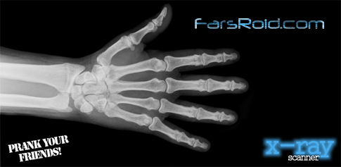 X-Ray Scanner - X-ray scanner for Android